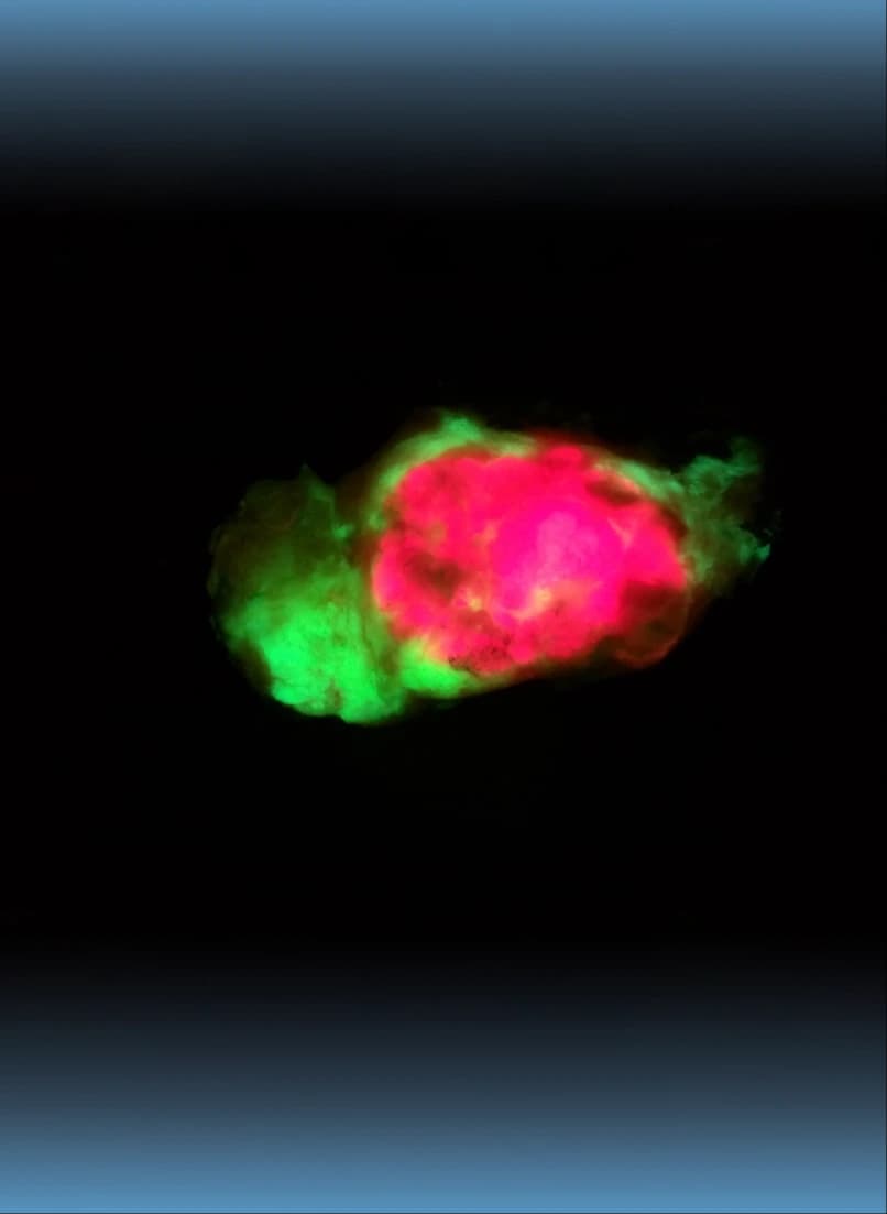Handheld Fluorescence Imaging