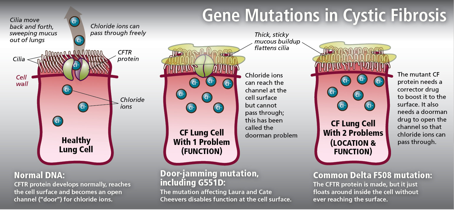 Gene Mutations in Cystic Fibrosis
